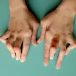 Kako se dijagnosticira reumatoidni artritis – prvi koraci prema razumijevanju bolesti