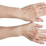 Male promjene koje čine veliku razliku u svakodnevnom životu s RA